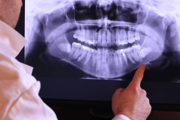 Best Emergency Gum Treatment in Cecilia, LA